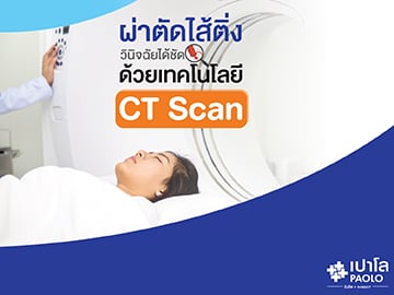 ผ่าตัดไส้ติ่ง วินิจฉัยได้ชัด ด้วยเทคโนโลยี CT Scan